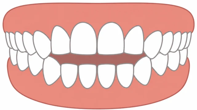 Open bite