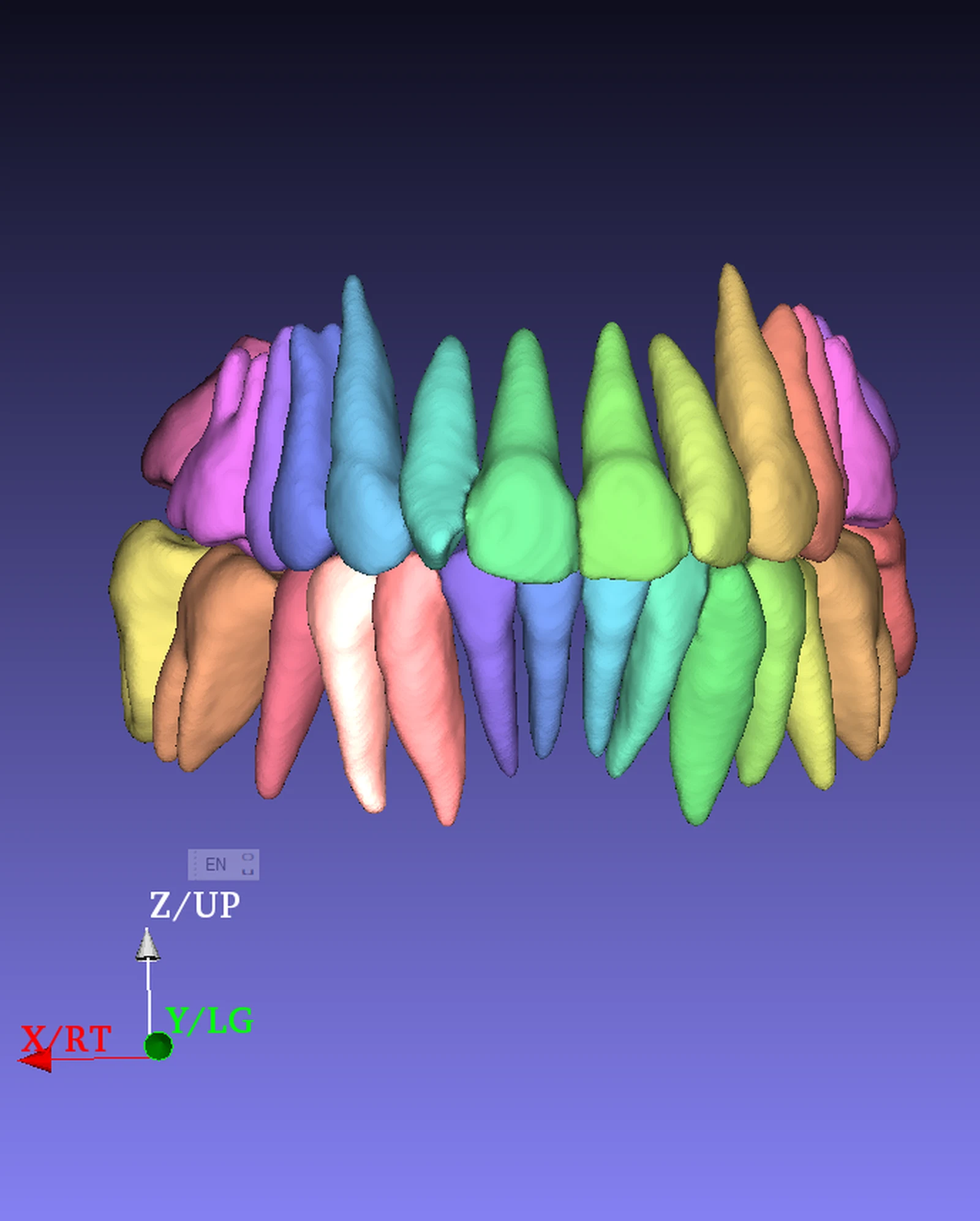 Per-tooth CBCT segmentation with each tooth isolated in a different colour