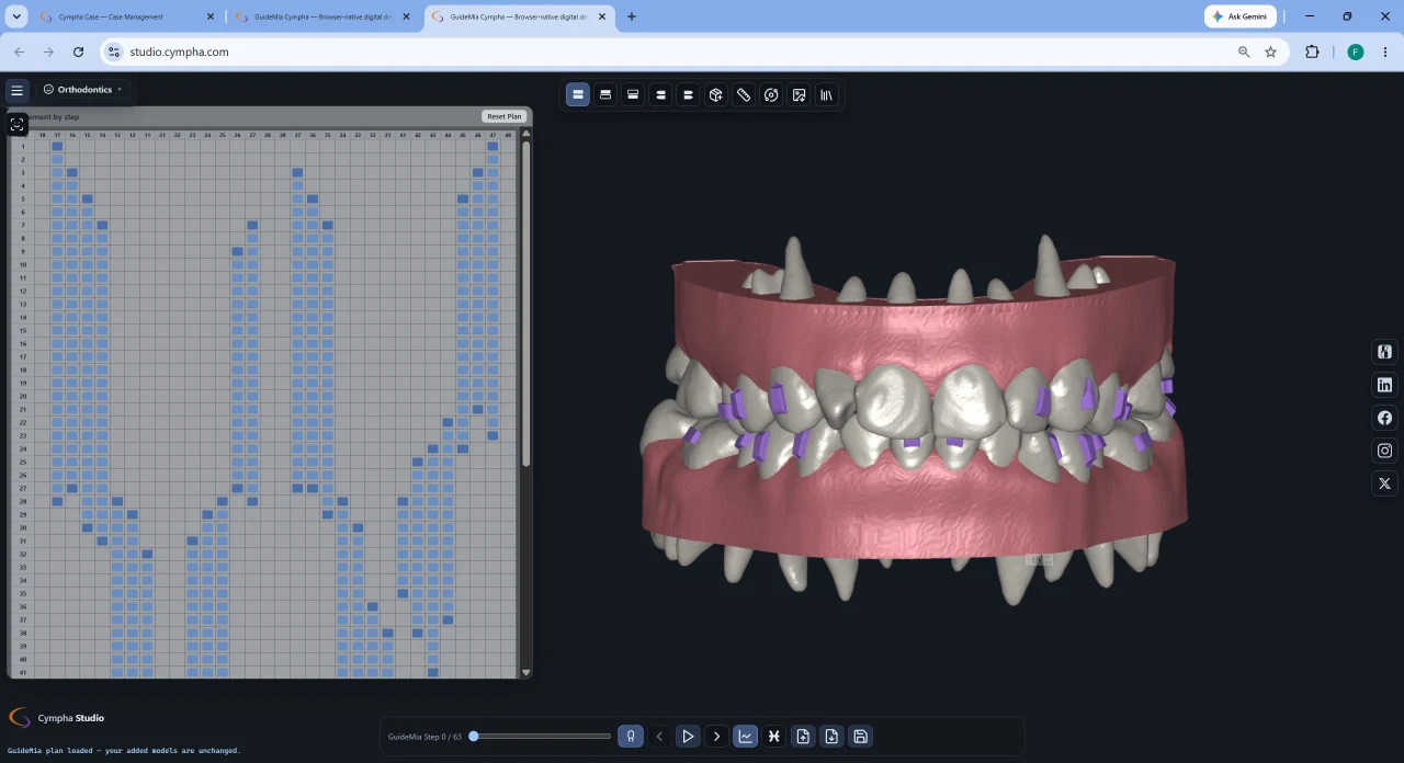 Cympha Studio in a browser, showing an aligner staging grid beside a 3D arch with attachments