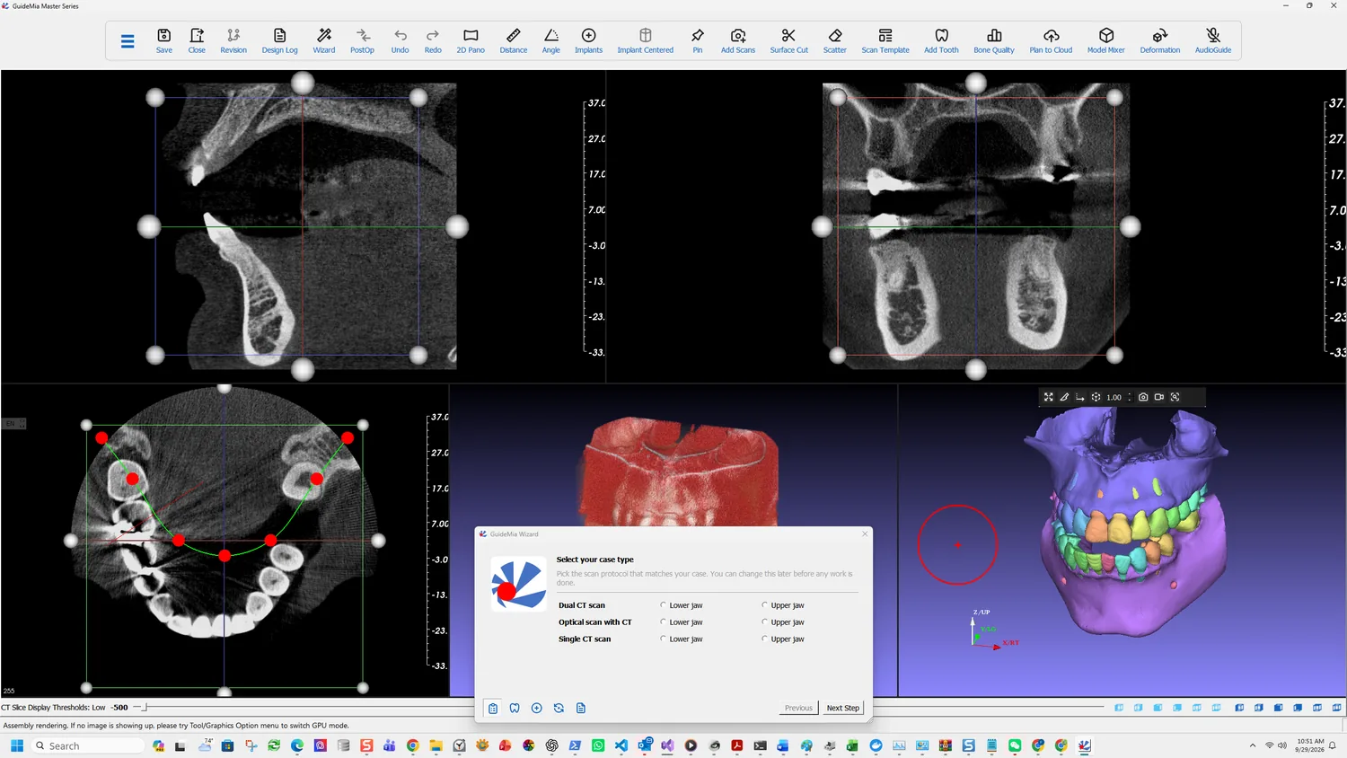 Select your case type — the Wizard's first page, over a workspace where the AI has already segmented the arches