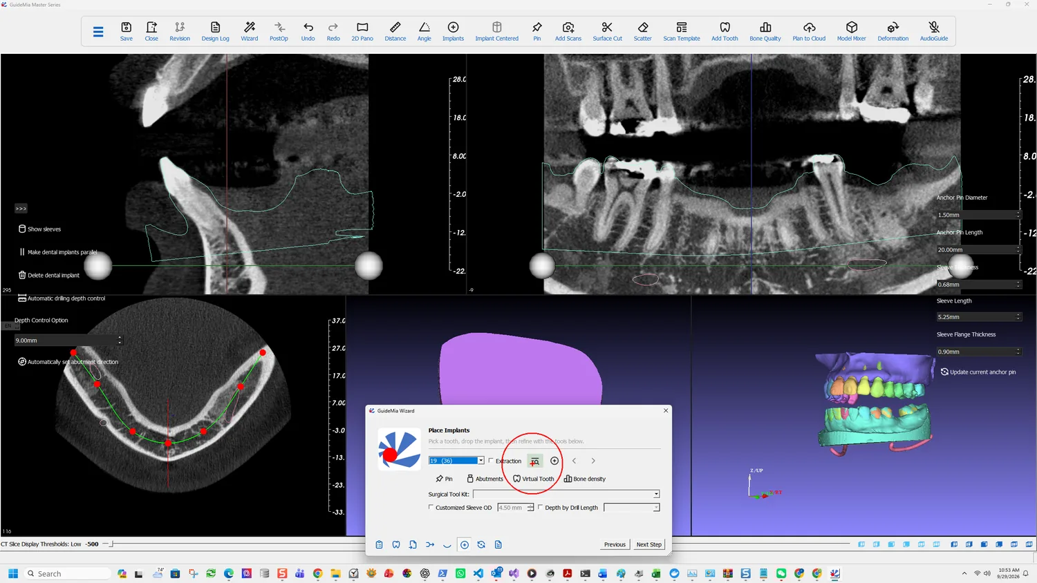 Place Implants, with the tooth chosen and Browse about to open the library