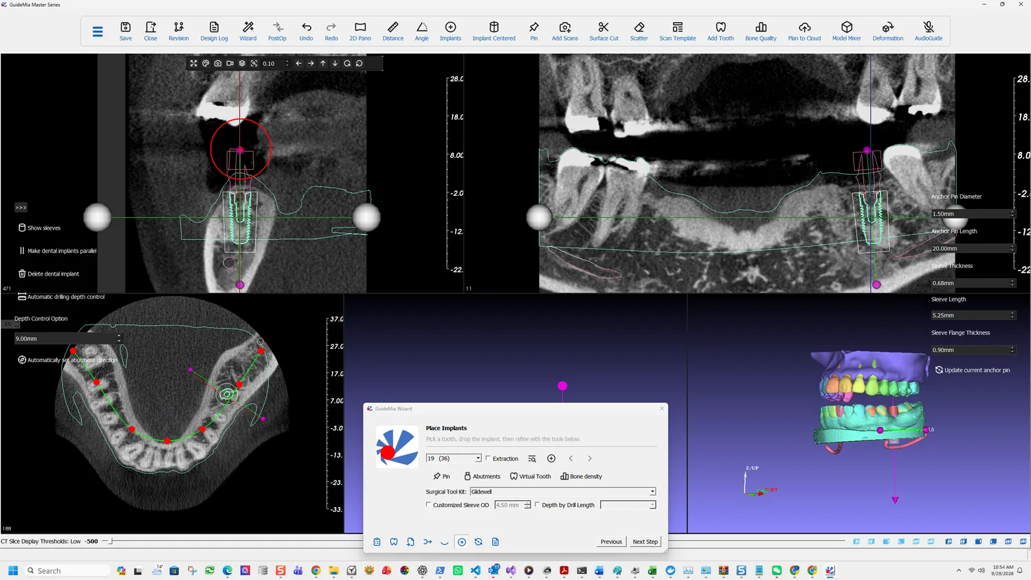 The sagittal view