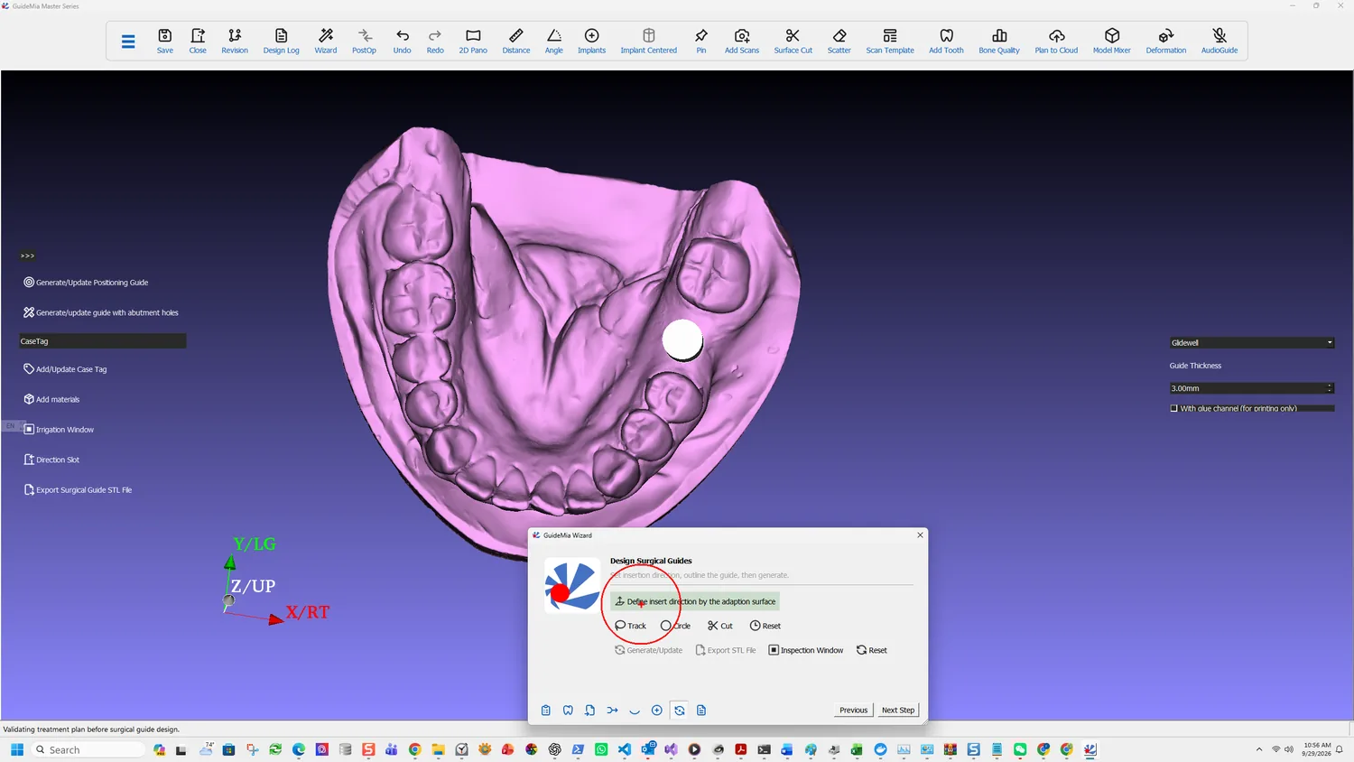 Define insert direction by the adaption surface
