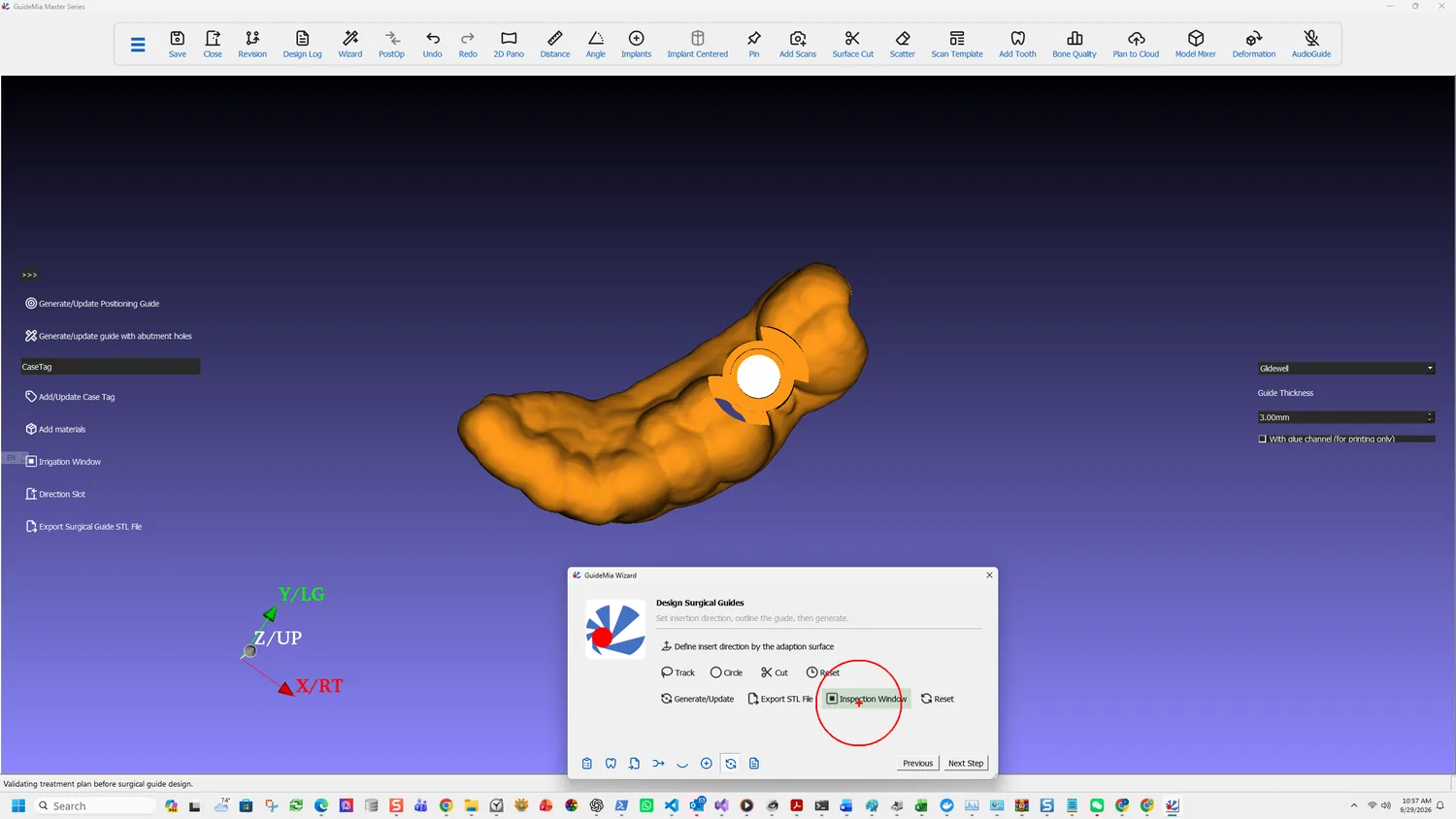 Adding an inspection window