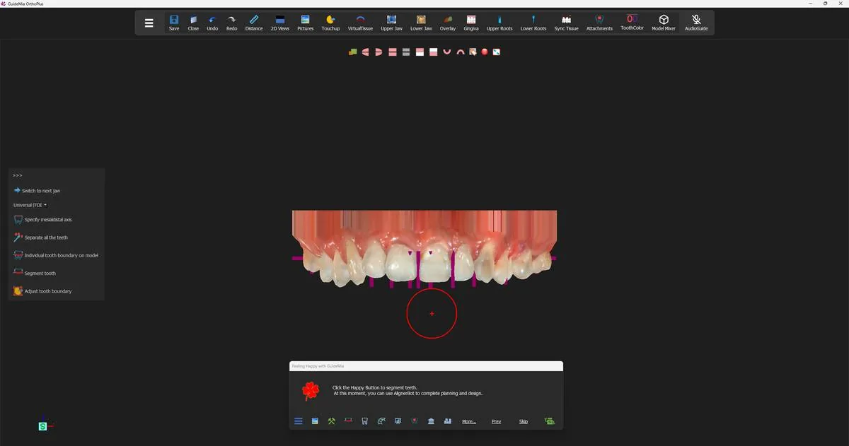 The finished base models, with the workflow now standing on tooth segmentation.