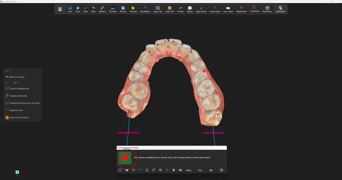 The tooth-number control preset to tooth 2 (FDI 17), with the segmentation about to run on the upper arch.