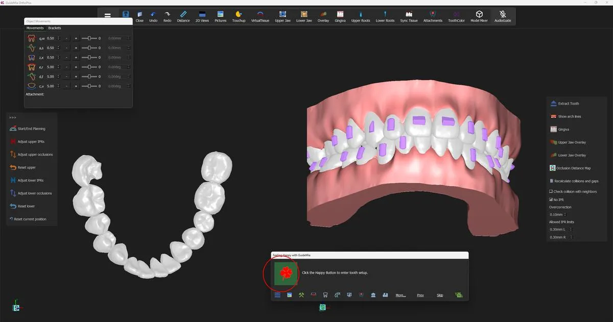 The case in tooth setup: the working object window on the left, the assembly on the right, and the manual tools on the panel.