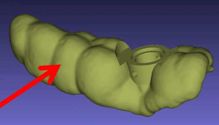 Inappropriate pressing of a surgical guide during surgery