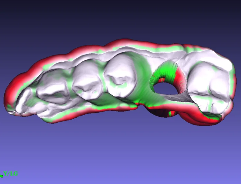 Guide design after the insertion path is adjusted