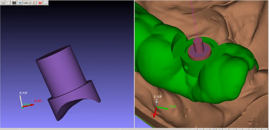 The inspection tool for surgical guide positioning