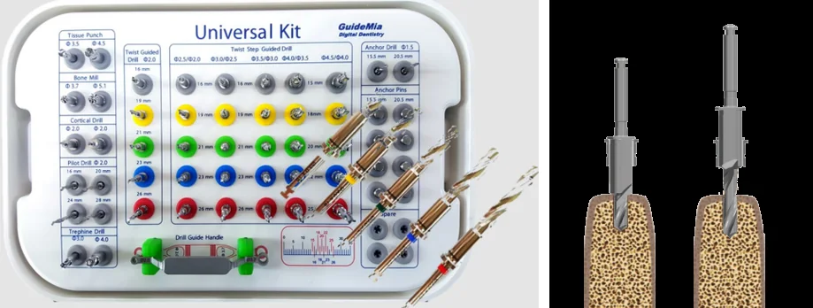 Illustration of the GuideMia surgical kit