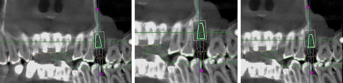 GuideMia error simulation