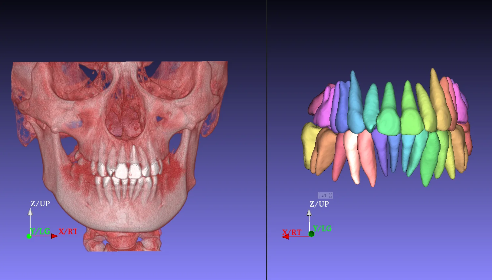 CBCT Segmentation