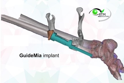 Beyond implants — additional clinical applications